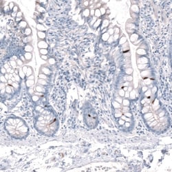 Choline Acetyltransferase/ChAT Antibody, Novus Biologicals 0.1mL; Unlabeled:Antibodies,